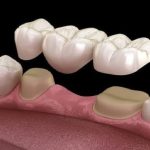 cosmetic dentistry in Manchester