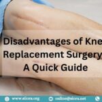 Knee Replacement Surgery